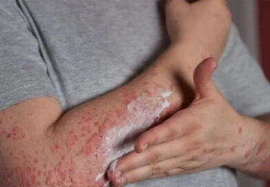 Salta registra 11 casos de lepra y convoca aun diagnóstico temprano