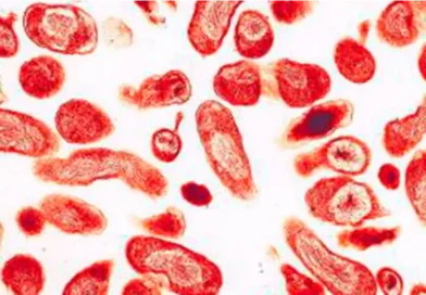 Fiebre Q en Entre Ríos: qué es, cuáles son los principales síntomas y las recomendaciones