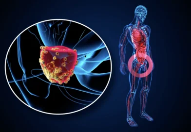 Lanzan una campaña de prevención del cáncer de próstata destinada a hombres sin cobertura social