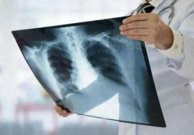 Los casos de tuberculosis aumentaron en Entre Ríos casi un 39% en lo que va de 2026